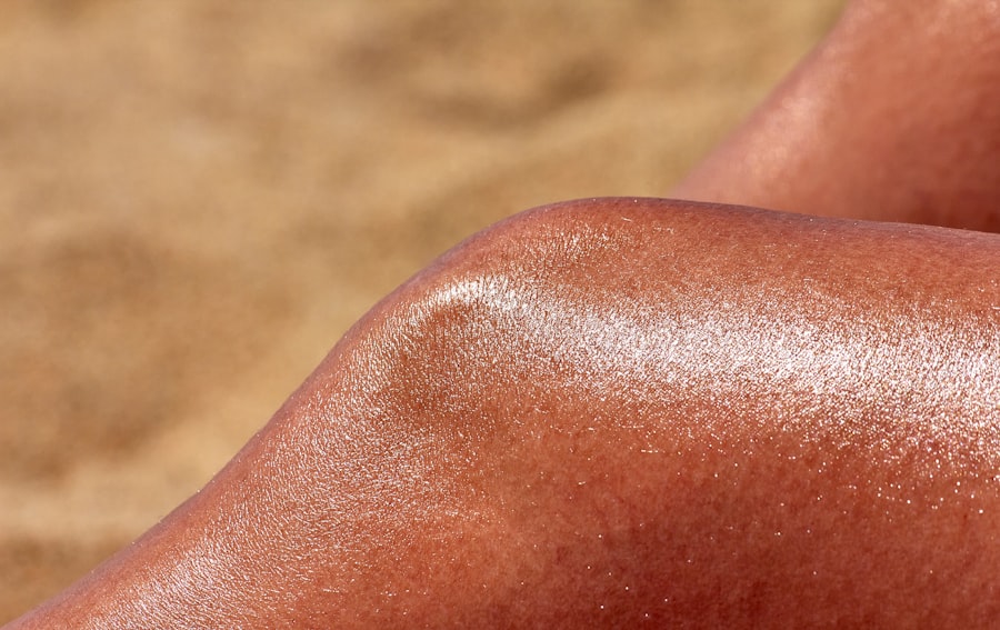 Photo Sunscreen bottle