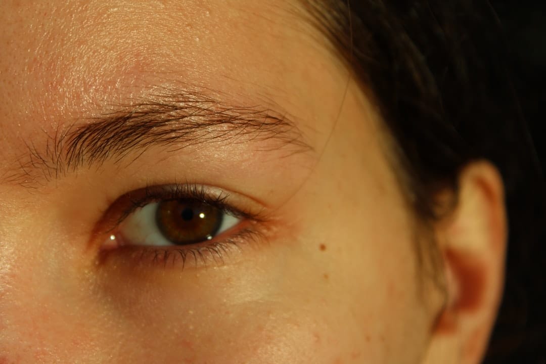 Photo Skin examination